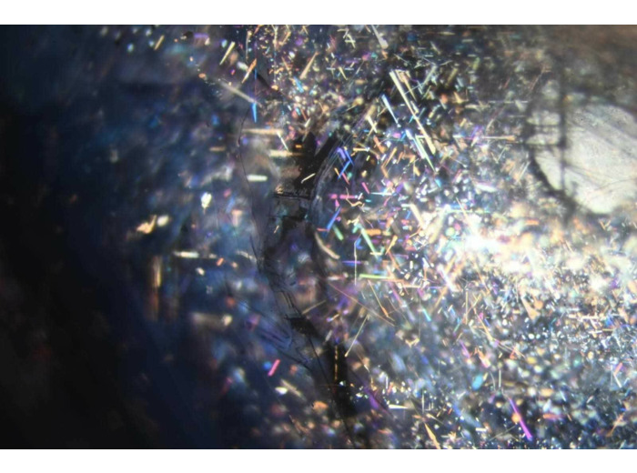 "Nuit étoilée" par Malo FRISTEL